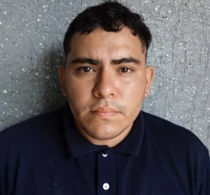 Preso padre que quemó a su hija con una cucharilla